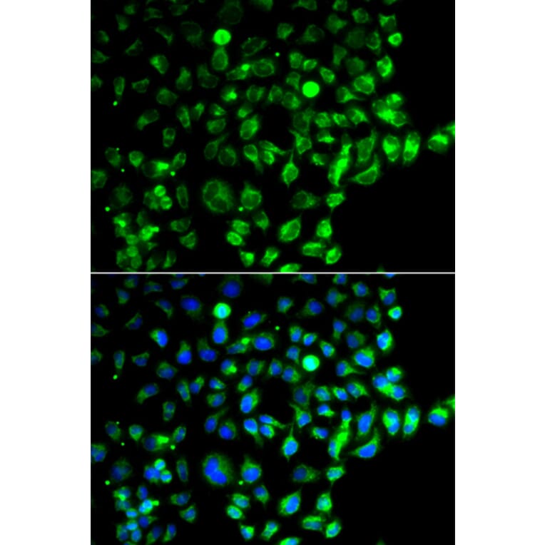 Immunofluorescence - Anti-RAB31 Antibody (A88789) - Antibodies.com