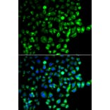 Immunofluorescence - Anti-RAB31 Antibody (A88789) - Antibodies.com