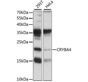 Western Blot - Anti-CRYBA4 Antibody (A88790) - Antibodies.com