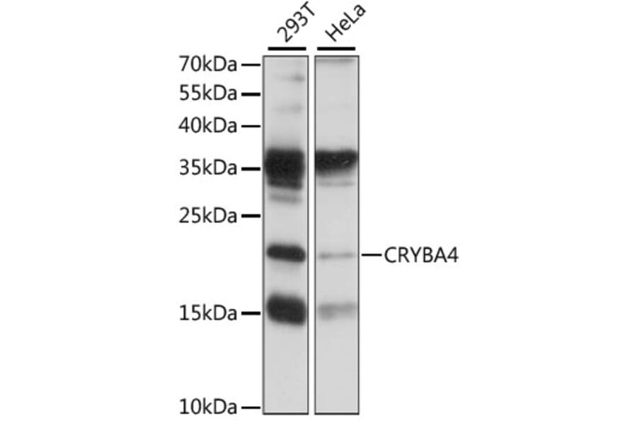 Western Blot - Anti-CRYBA4 Antibody (A88790) - Antibodies.com