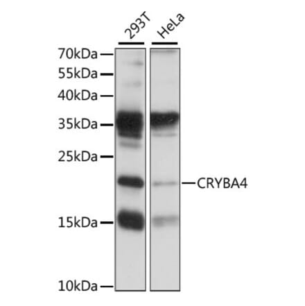 Western Blot - Anti-CRYBA4 Antibody (A88790) - Antibodies.com