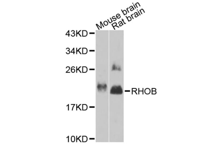 Western Blot - Anti-RHOB Antibody (A12402) - Antibodies.com