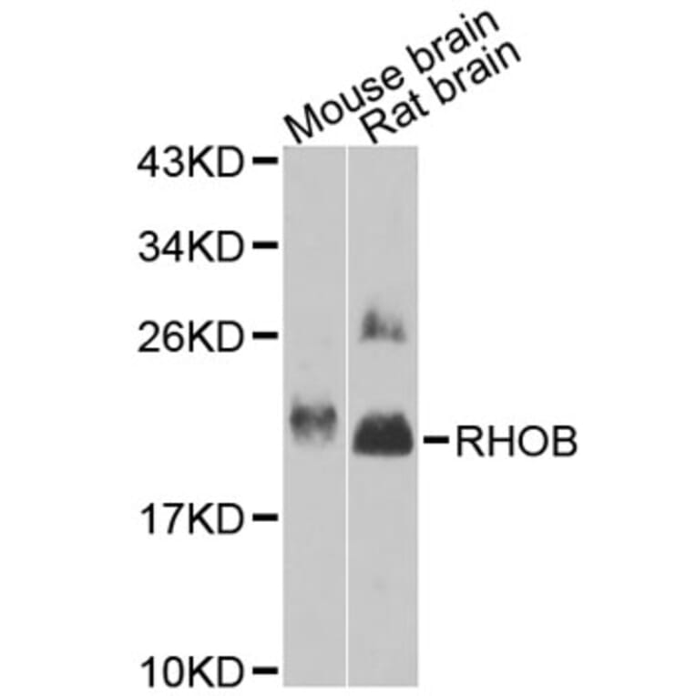 Western Blot - Anti-RHOB Antibody (A12402) - Antibodies.com