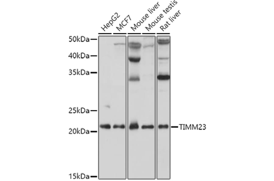 Western Blot - Anti-TIMM23/TIM23 Antibody (A88792) - Antibodies.com
