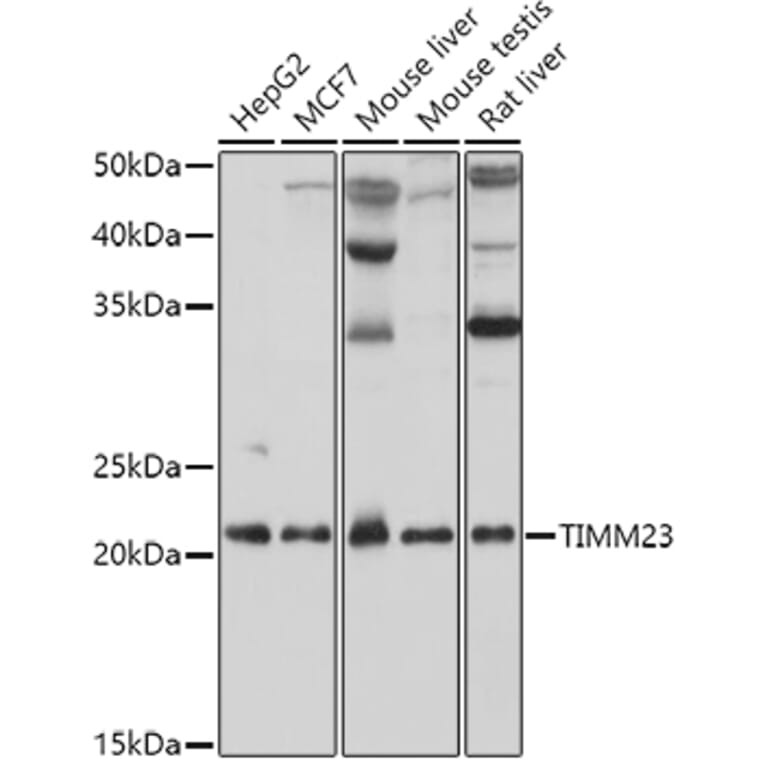 Western Blot - Anti-TIMM23/TIM23 Antibody (A88792) - Antibodies.com