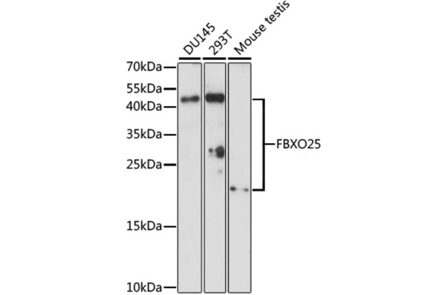 Western Blot - Anti-FBXO25 Antibody (A88793) - Antibodies.com