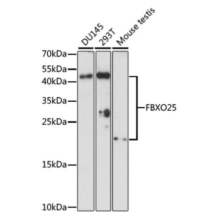 Western Blot - Anti-FBXO25 Antibody (A88793) - Antibodies.com