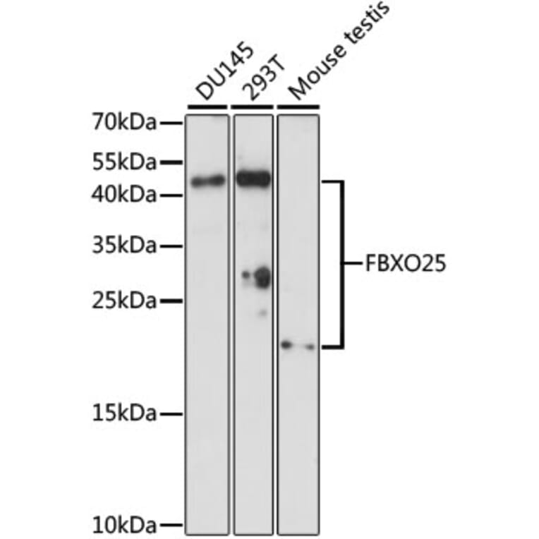 Western Blot - Anti-FBXO25 Antibody (A88793) - Antibodies.com