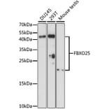 Western Blot - Anti-FBXO25 Antibody (A88793) - Antibodies.com