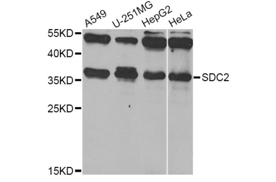Western Blot - Anti-SDC2 Antibody (A12500) - Antibodies.com