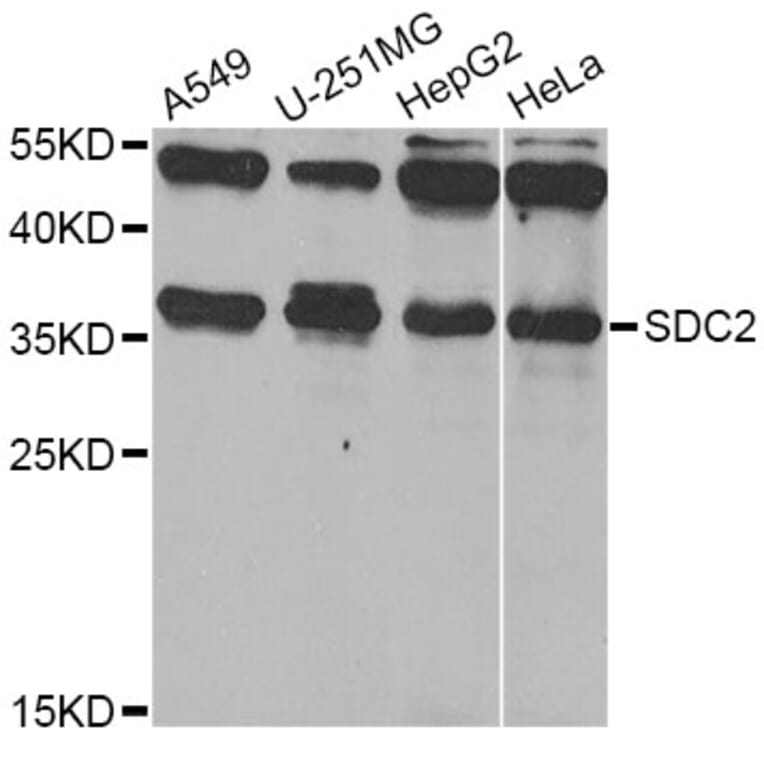 Western Blot - Anti-SDC2 Antibody (A12500) - Antibodies.com