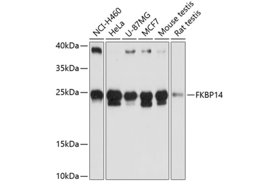 Western Blot - Anti-FKBP14 Antibody (A88795) - Antibodies.com
