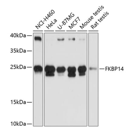 Western Blot - Anti-FKBP14 Antibody (A88795) - Antibodies.com