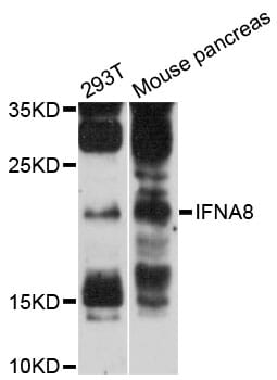 Western blot analysis of extracts of various cell lines, using Anti-IFNA8 Antibody (A12747) at 1:3000 dilution.
Secondary antibody: Goat Anti-Rabbit IgG (H+L) (HRP) (AS014) at 1:10,000 dilution.
Lysates / proteins: 25µg per lane.
Blocking buffer: 3% non-fat dry milk in TBST.
Detection: ECL Enhanced Kit (RM00021).
Exposure time: 90s.