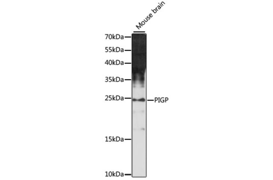 Western Blot - Anti-PIGP Antibody (A88797) - Antibodies.com