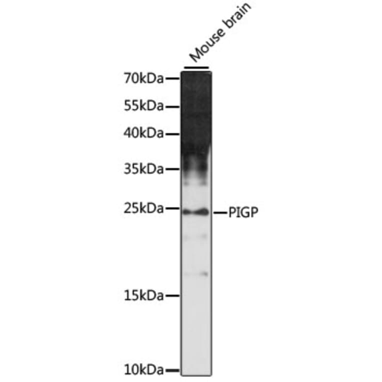 Western Blot - Anti-PIGP Antibody (A88797) - Antibodies.com