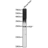 Western Blot - Anti-PIGP Antibody (A88797) - Antibodies.com