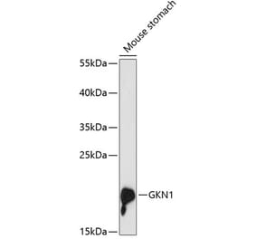 Western Blot - Anti-Gastrokine 1 Antibody (A88798) - Antibodies.com