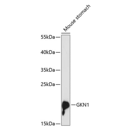 Western Blot - Anti-Gastrokine 1 Antibody (A88798) - Antibodies.com