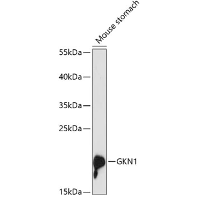 Western Blot - Anti-Gastrokine 1 Antibody (A88798) - Antibodies.com