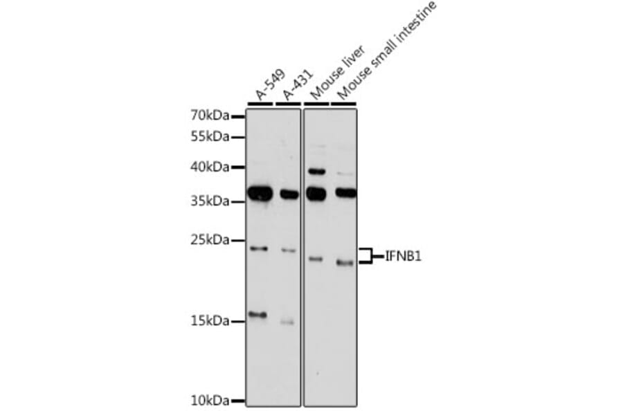 Western Blot - Anti-Interferon beta Antibody (A88799) - Antibodies.com