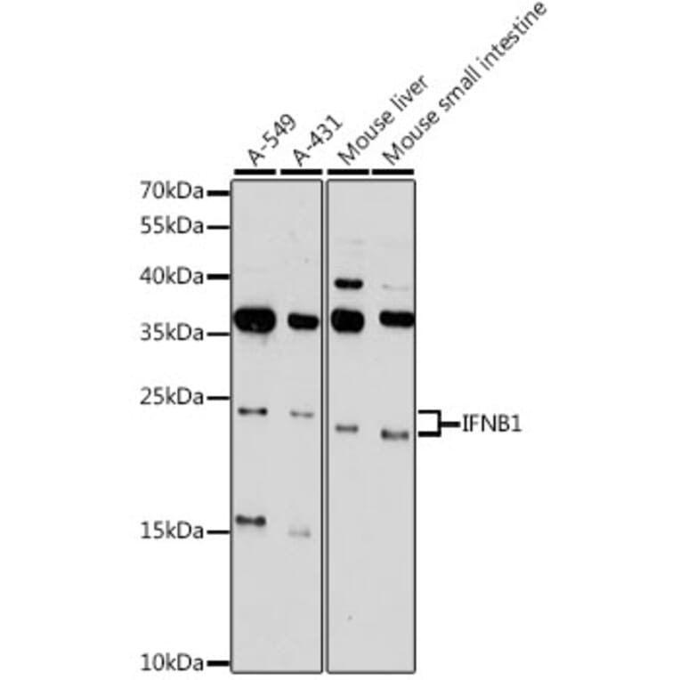 Western Blot - Anti-Interferon beta Antibody (A88799) - Antibodies.com