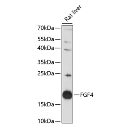 Western Blot - Anti-FGF4 Antibody (A88800) - Antibodies.com