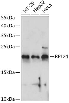 Western blot analysis of extracts of various cell lines, using Anti-RPL24 Antibody (A14255) at 1:1,000 dilution.
Secondary antibody: Goat Anti-Rabbit IgG (H+L) (HRP) (AS014) at 1:10,000 dilution.
Lysates / proteins: 25µg per lane.
Blocking buffer: 3% non-fat dry milk in TBST.
Detection: ECL Basic Kit (RM00020).
Exposure time: 60s.