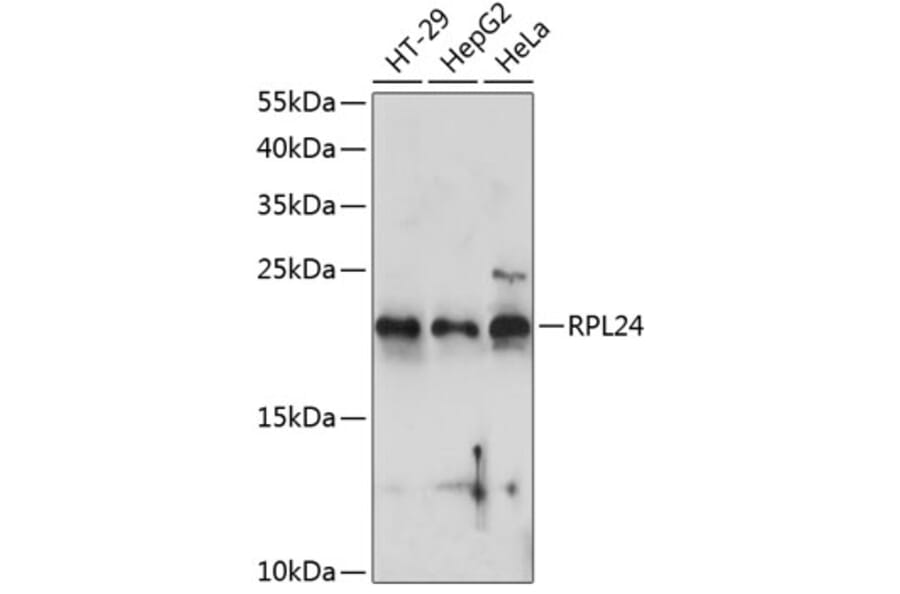 Western Blot - Anti-RPL24 Antibody (A88801) - Antibodies.com