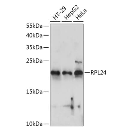 Western Blot - Anti-RPL24 Antibody (A88801) - Antibodies.com