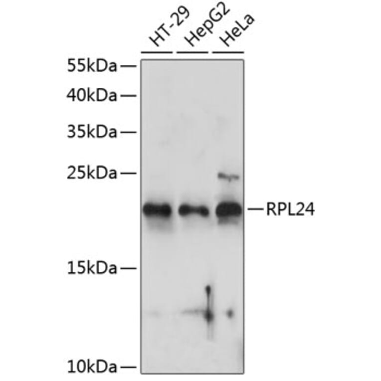 Western Blot - Anti-RPL24 Antibody (A88801) - Antibodies.com