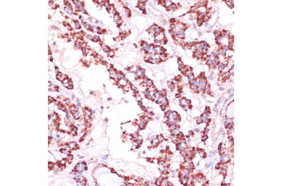 Immunohistochemistry - Anti-RPL24 Antibody (A88801) - Antibodies.com