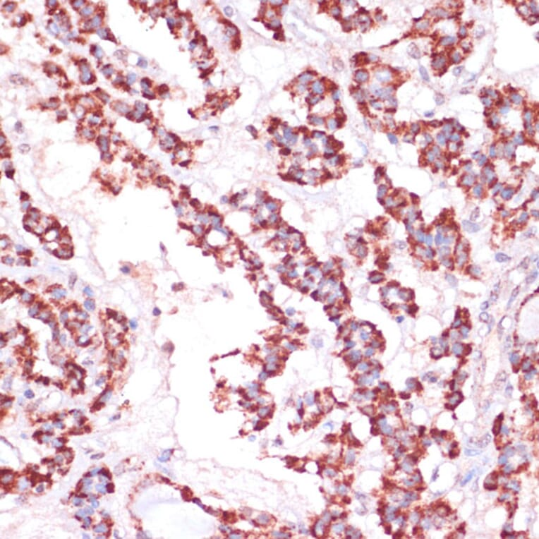 Immunohistochemistry - Anti-RPL24 Antibody (A88801) - Antibodies.com