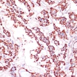 Immunohistochemistry - Anti-RPL24 Antibody (A88801) - Antibodies.com