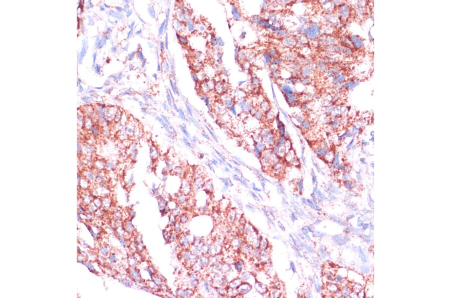 Immunohistochemistry - Anti-RPL24 Antibody (A88801) - Antibodies.com
