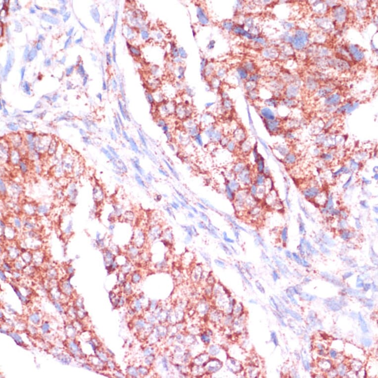 Immunohistochemistry - Anti-RPL24 Antibody (A88801) - Antibodies.com