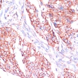 Immunohistochemistry - Anti-RPL24 Antibody (A88801) - Antibodies.com