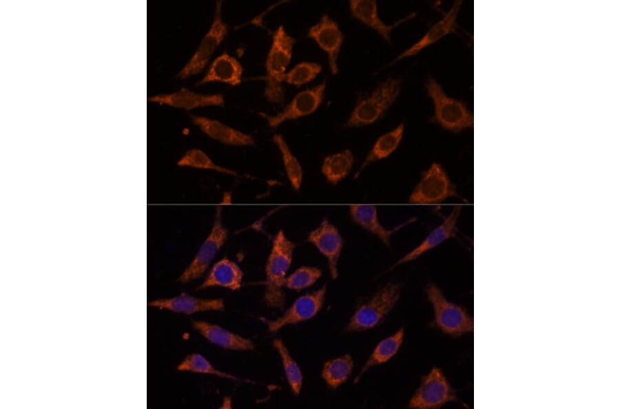 Immunofluorescence - Anti-RPL24 Antibody (A88801) - Antibodies.com