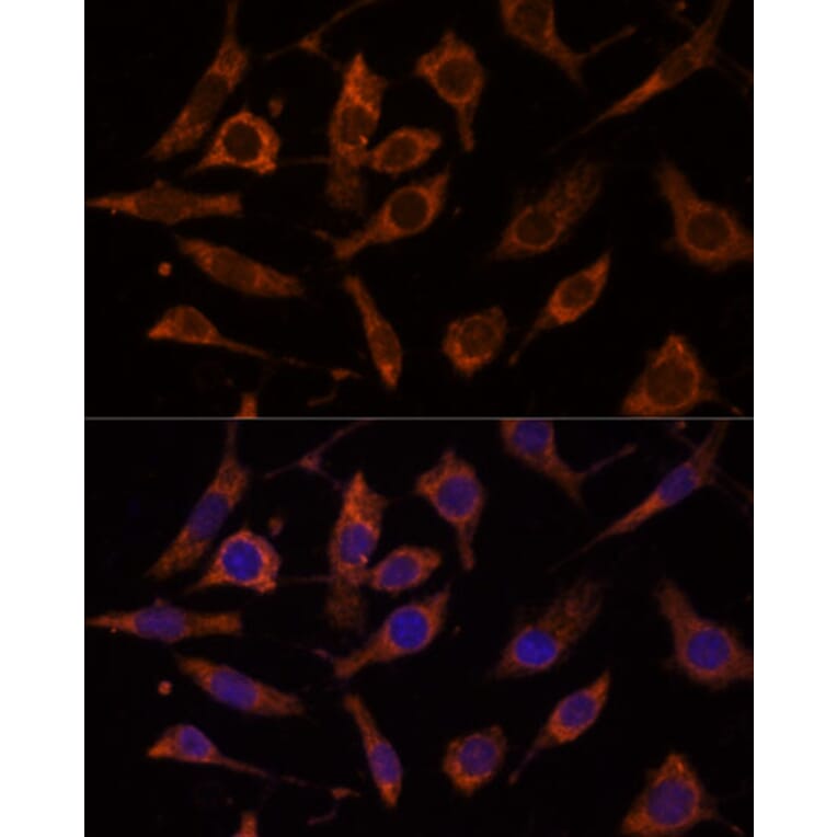 Immunofluorescence - Anti-RPL24 Antibody (A88801) - Antibodies.com