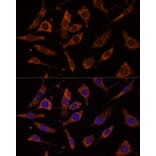 Immunofluorescence - Anti-RPL24 Antibody (A88801) - Antibodies.com
