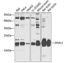 Western Blot - Anti-DNAL1 Antibody (A88802) - Antibodies.com