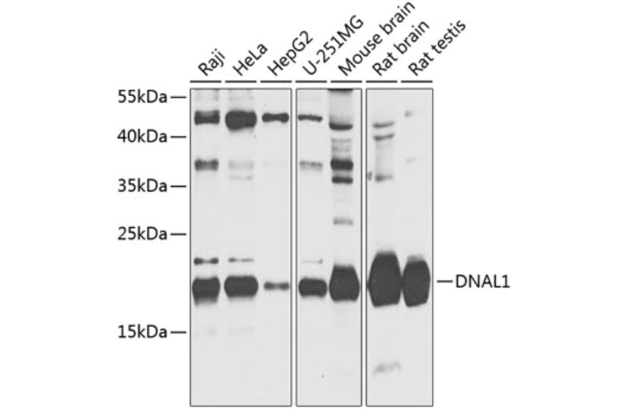 Western Blot - Anti-DNAL1 Antibody (A88802) - Antibodies.com