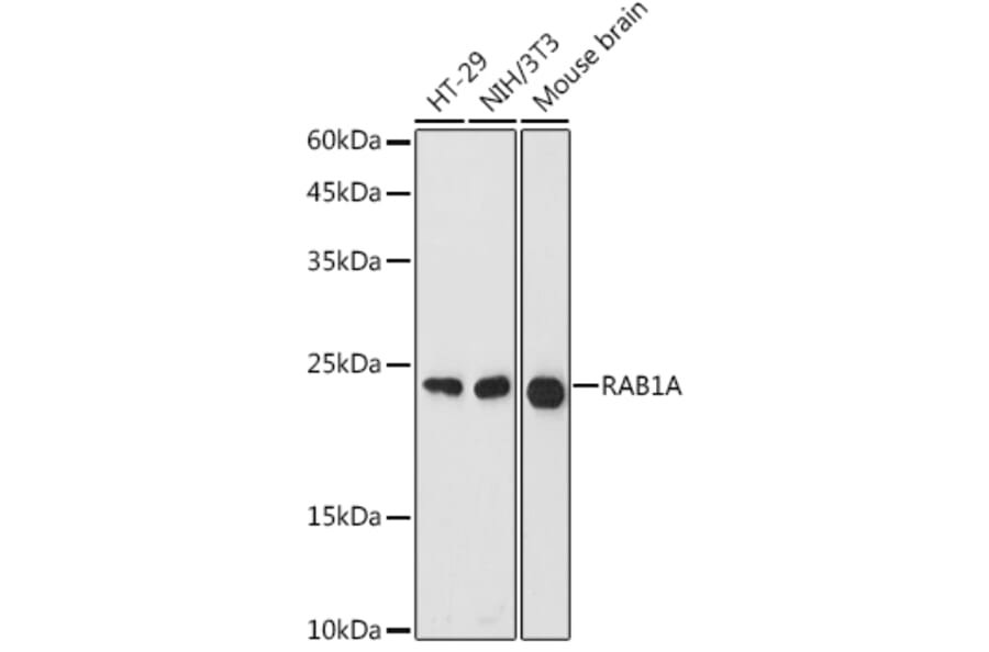 Western Blot - Anti-Rab1A Antibody (A88803) - Antibodies.com