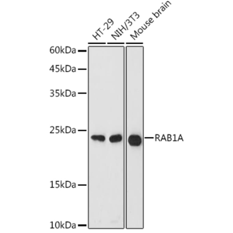 Western Blot - Anti-Rab1A Antibody (A88803) - Antibodies.com