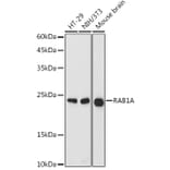 Western Blot - Anti-Rab1A Antibody (A88803) - Antibodies.com