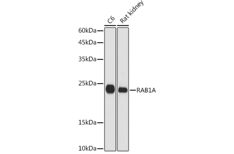 Western Blot - Anti-Rab1A Antibody (A88803) - Antibodies.com