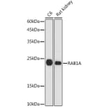 Western Blot - Anti-Rab1A Antibody (A88803) - Antibodies.com