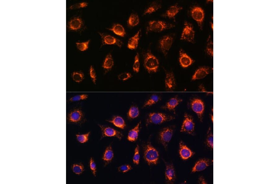 Immunofluorescence - Anti-Rab1A Antibody (A88803) - Antibodies.com