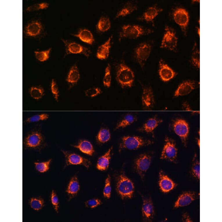 Immunofluorescence - Anti-Rab1A Antibody (A88803) - Antibodies.com