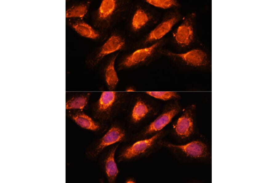Immunofluorescence - Anti-Rab1A Antibody (A88803) - Antibodies.com